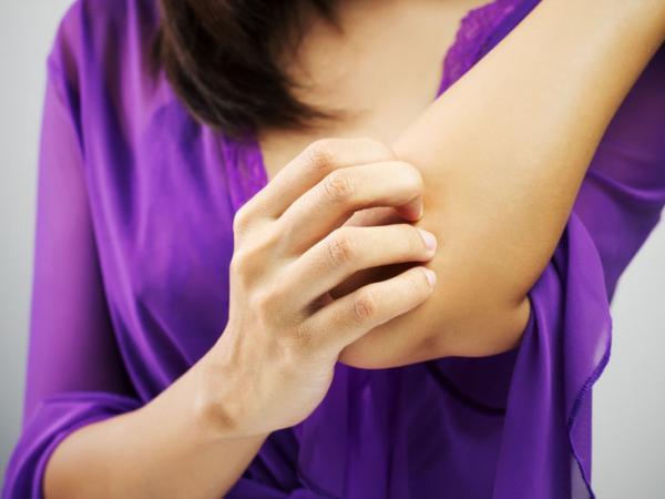 10 درمان خانگی برای مبارزه با عفونت قارچی پوست