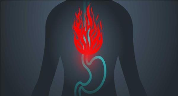 رفلاکس معده یا ترش کردن